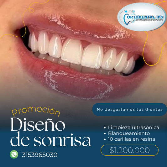 DISEÑO DE SONRISA